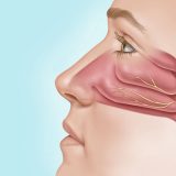 Posterior Nasal Nerve